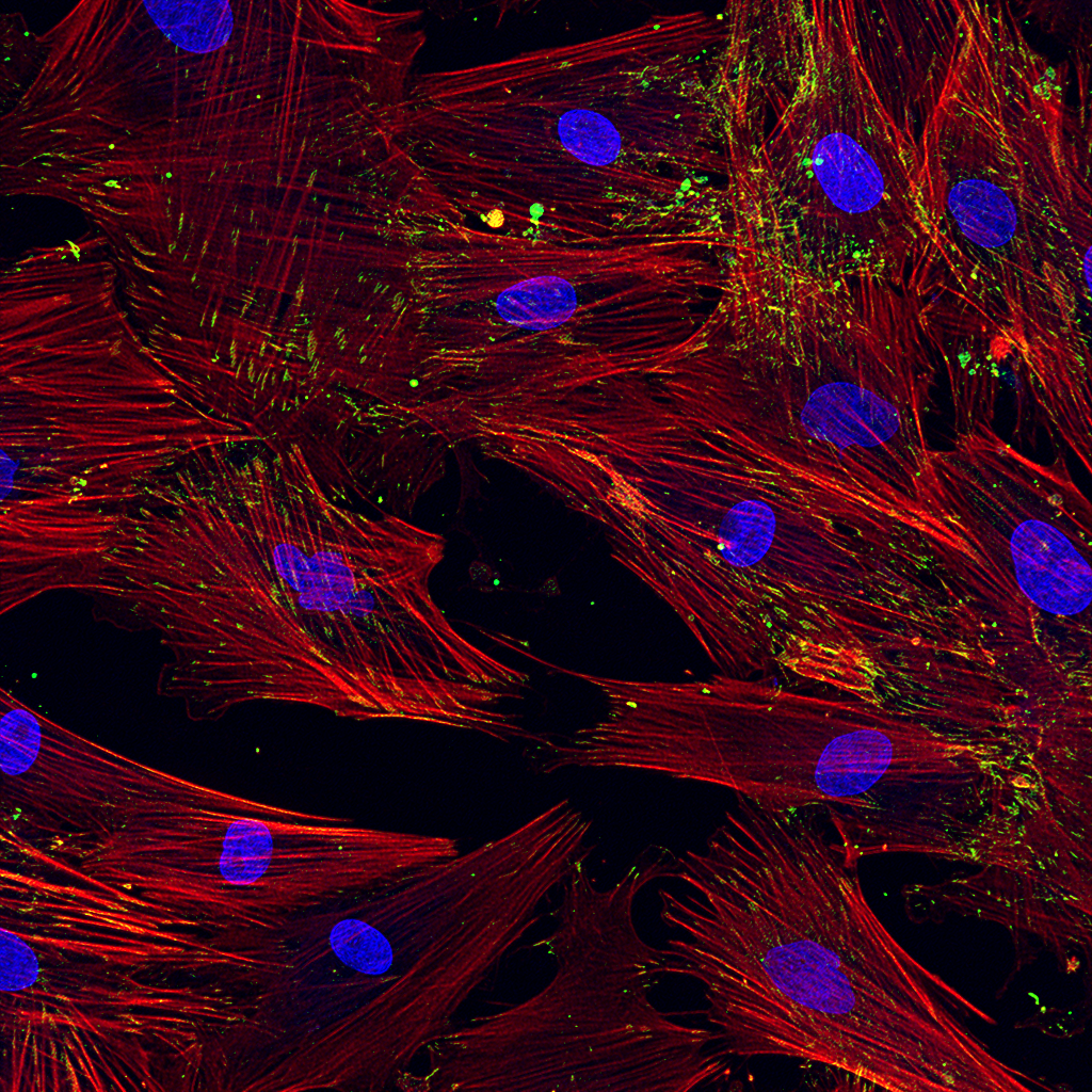 Vasoactive intestinal peptide exerts an osteoinductive effect in human mesenchymal stem cells